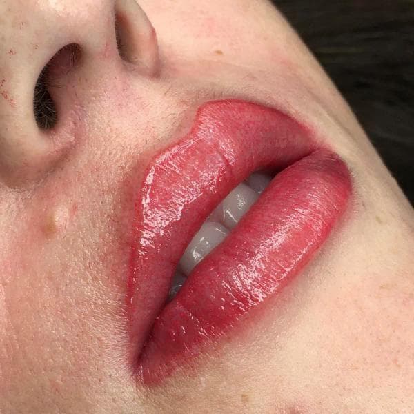 Micro Labial